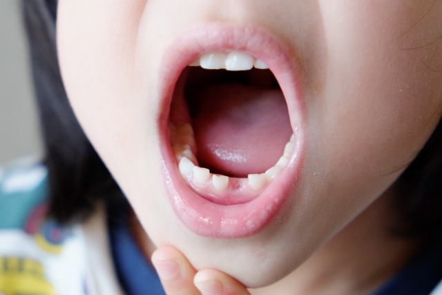 乳歯の早期脱落