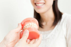 「歯ぎしり」の原因と予防